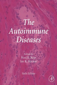 copertina di The Autoimmune Diseases