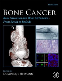 copertina di Bone Cancer : Bone Sarcomas and Bone Metastases - from Bench to Bedside