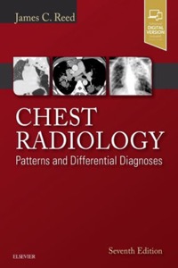 copertina di Chest Radiology - Patterns and Differential Diagnoses