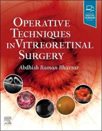 copertina di Operative Techniques in Vitreoretinal Surgery
