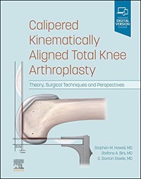 copertina di Calipered Kinematically aligned Total Knee Arthroplasty