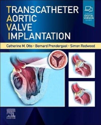 copertina di Transcatheter Aortic Valve Implantation 