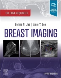 copertina di Breast Imaging : The Core Requisites