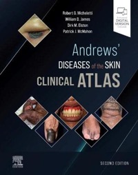 copertina di Andrews' Diseases of the Skin Clinical Atlas