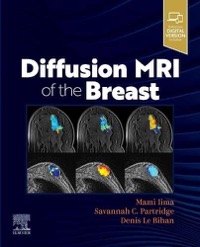 copertina di Diffusion MRI of the Breast