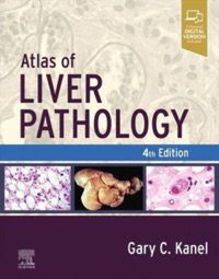 copertina di Atlas of Liver Pathology
