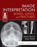 copertina di Image Interpretation - Bones, Joints, and Fractures