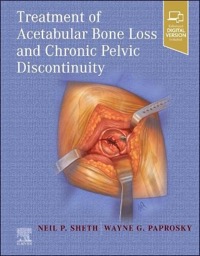 copertina di Treatment of Acetabular Bone Loss and Chronic Pelvic Discontinuity