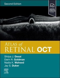 copertina di Atlas of Retinal OCT - Optical Coherence Tomography 