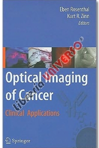 Optical Imaging of Cancer- Clinical Applications