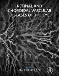 copertina di Retinal and Choroidal Vascular Diseases of the Eye