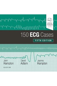 copertina di 150 ECG Cases