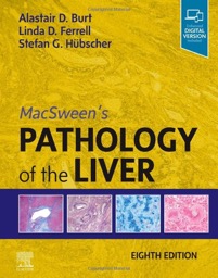 copertina di MacSween' s Pathology of the Liver