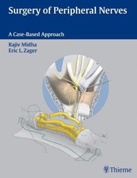 copertina di Surgery of Peripheral Nerves - A Case - Based Approach