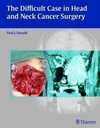 copertina di The Difficult Case in Head and Neck Cancer Surgery