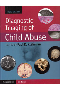 copertina di Diagnostic Imaging of Child Abuse