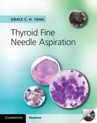 copertina di Thyroid Fine Needle Aspiration - with CD Extra