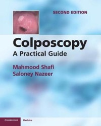 copertina di Colposcopy - A Practical Guide