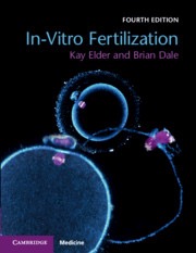 copertina di In-Vitro Fertilization