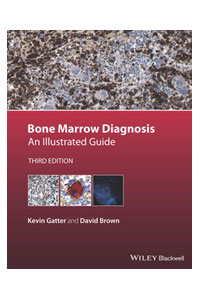 copertina di Bone Marrow Diagnosis : An Illustrated Guide
