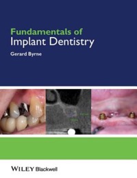 copertina di Fundamentals of Implant Dentistry
