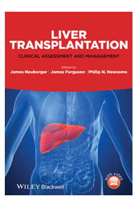 copertina di Liver Transplantation: Clinical Assessment and Management