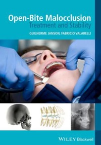 copertina di Open - Bite Malocclusion: Treatment and Stability