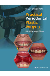 copertina di Practical Periodontal Plastic Surgery