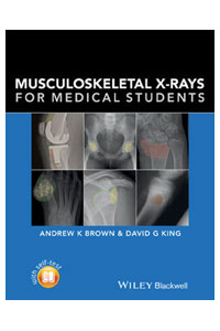 copertina di Musculoskeletal X - rays for Medical Students