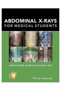 copertina di Abdominal X - rays for Medical Students