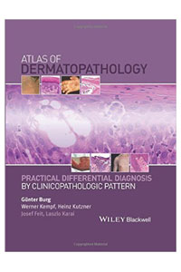 copertina di Atlas of Dermatopathology : Practical Differential Diagnosis by Clinicopathologic ...