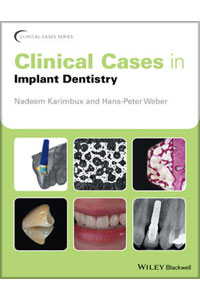 copertina di Clinical Cases in Implant Dentistry