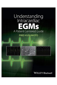 copertina di Understanding Intracardiac EGMs: A Patient Centered Guide