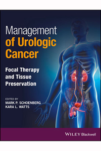 copertina di Management of Urologic Cancer: Focal Therapy and Tissue Preservation