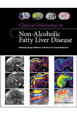 copertina di Clinical Dilemmas in Non - Alcoholic Fatty Liver Disease