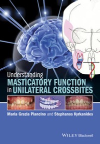 copertina di Understanding Masticatory Function in Unilateral Crossbites