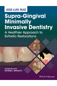 copertina di Supra - Gingival Minimally Invasive Dentistry: A Healthier Approach to Esthetic Restorations