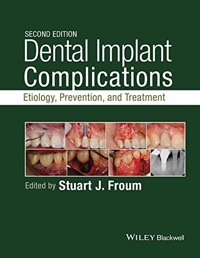 copertina di Dental Implant Complications : Etiology, Prevention, and Treatment