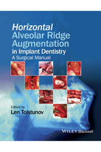 copertina di Horizontal Alveolar Ridge Augmentation in Implant Dentistry: A Surgical Manual
