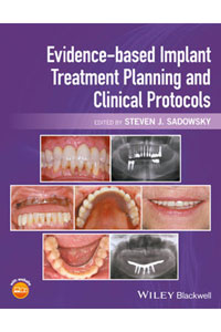copertina di Evidence - based Implant Treatment Planning and Clinical Protocols