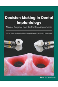 copertina di Decision Making in Dental Implantology: Atlas of Surgical and Restorative Approaches