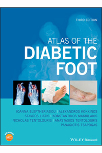 copertina di Atlas of the Diabetic Foot