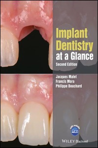copertina di Implant Dentistry at a Glance
