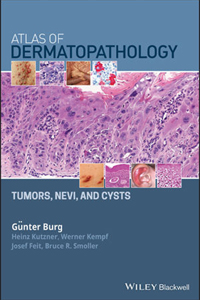 copertina di Atlas of Dermatopathology: Tumors, Nevi, and Cysts