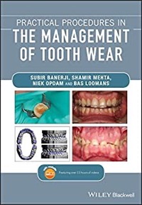 copertina di Practical Procedures in the Management of Tooth Wear