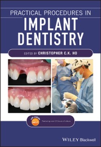 copertina di Practical Procedures in Implant Dentistry