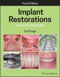 copertina di Implant Restorations: A Step - by - step Guide