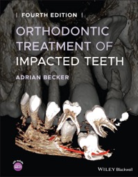 copertina di Orthodontic Treatment of Impacted Teeth