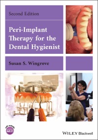 copertina di Peri - Implant Therapy for the Dental Hygienist