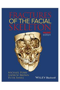 copertina di Fractures of the Facial Skeleton